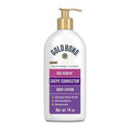 Gold Bond Age Renew Hand and Body Lotion Ultimate Crepe Corrector - Unscented - 14oz
